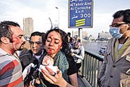 多名民眾與警方衝突時受傷，血流披面。